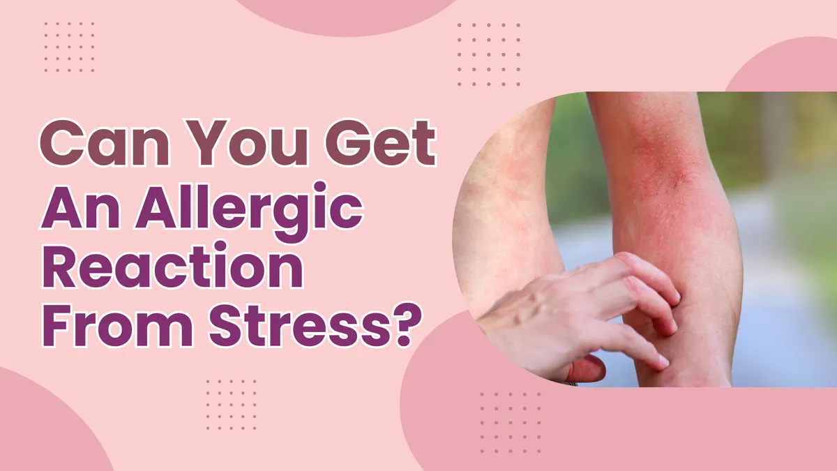 Can You Get An Allergic Reaction From Stress?
