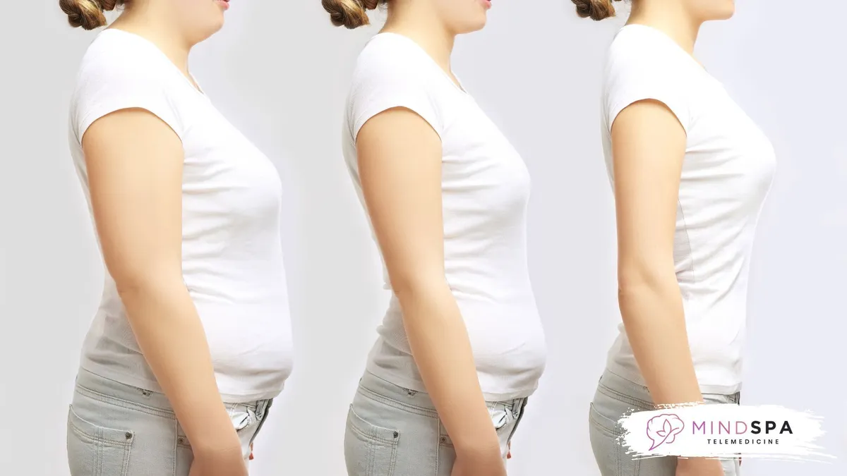 Preoccupation with weight, food, and body shape 