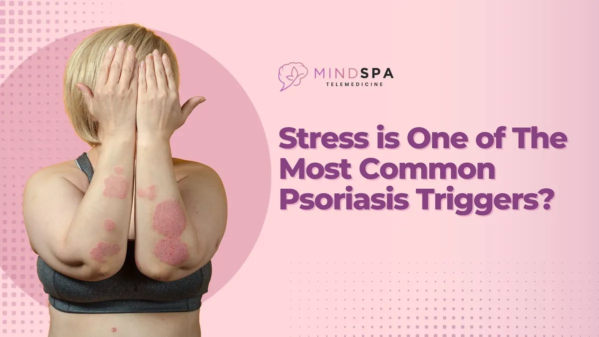 Did You Know Stress is One of The Most Common Psoriasis Triggers?